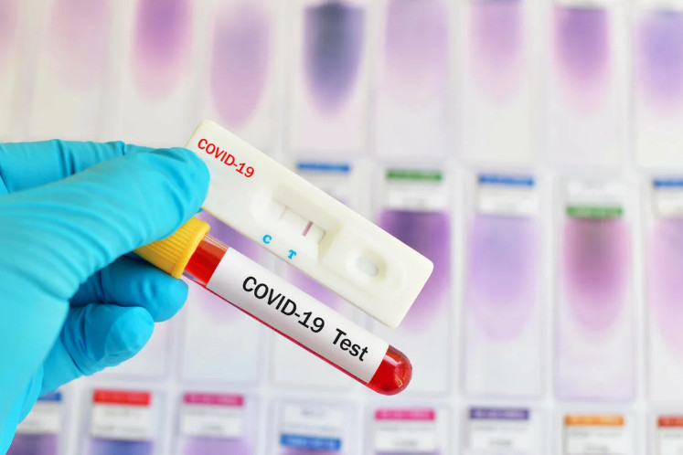 Обнаружение коронавируса: что такое ПЦР-тест?