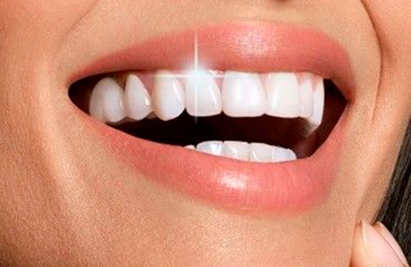 Безопасное отбеливание зубов в Polimagia.by - все простым языком
